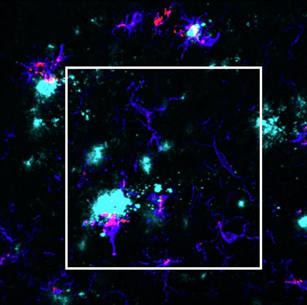 A cell image showing immune cells in the brain (microglia) (blue) signaling TSPO (red) and clustered around plaques (cyan)