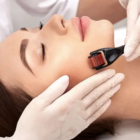 Getty Images Micro derma facial roller