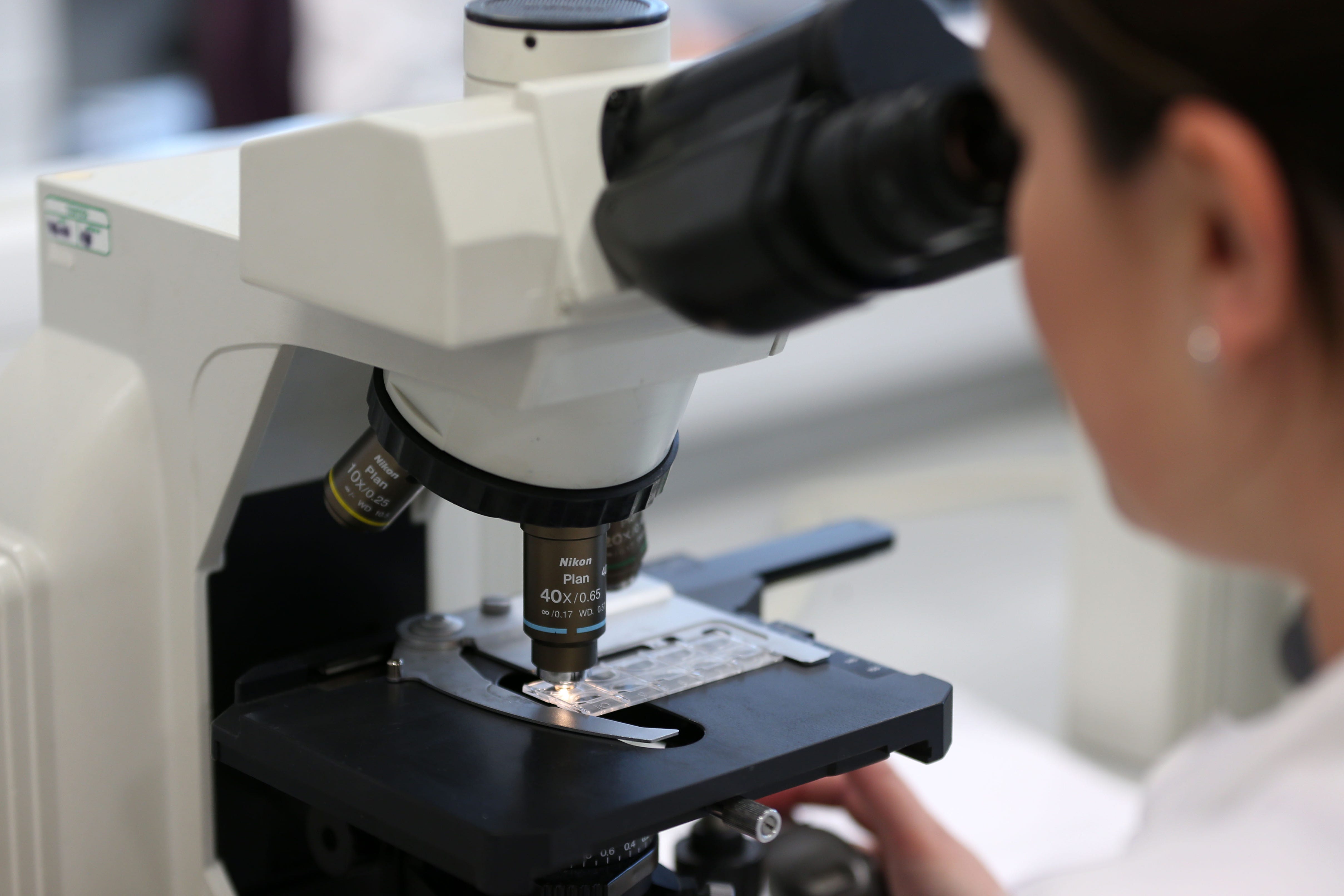 The team, funded by the ICR and Breast Cancer Now, used lab-grown mini tumours designed to model the way cancer behaves in the human body
