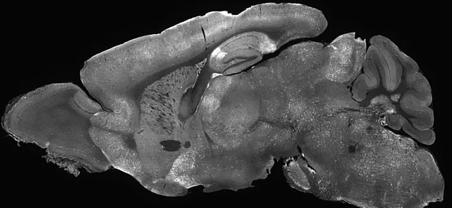 The above is the cross section of the brain of a mouse in the study. The highlighted areas represent locations where the adenovirus delivered the treatment to the brain