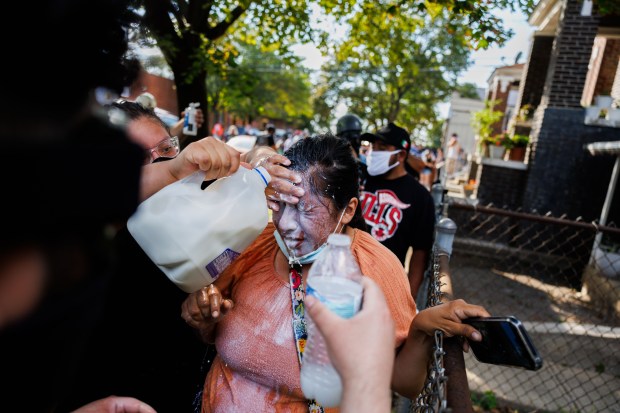 A woman is given milk to ease the pain in...